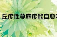 丘疹性荨麻疹能自愈吗（丘疹性荨麻疹图片）