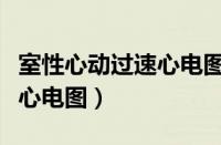 室性心动过速心电图会误诊吗（室性心动过速心电图）