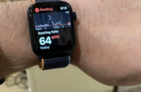 带有葡萄糖传感器的AppleWatch可能不会很快亮相