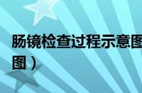 肠镜检查过程示意图动画（肠镜检查过程示意图）