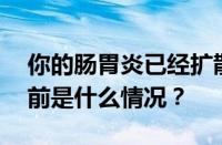 你的肠胃炎已经扩散到头部了吗是什么梗 目前是什么情况？